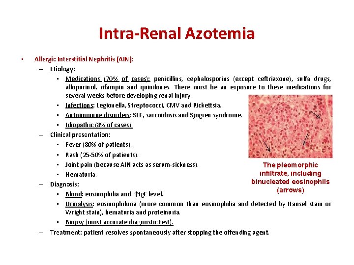 Intra-Renal Azotemia • Allergic Interstitial Nephritis (AIN): – Etiology: • Medications (70% of cases):