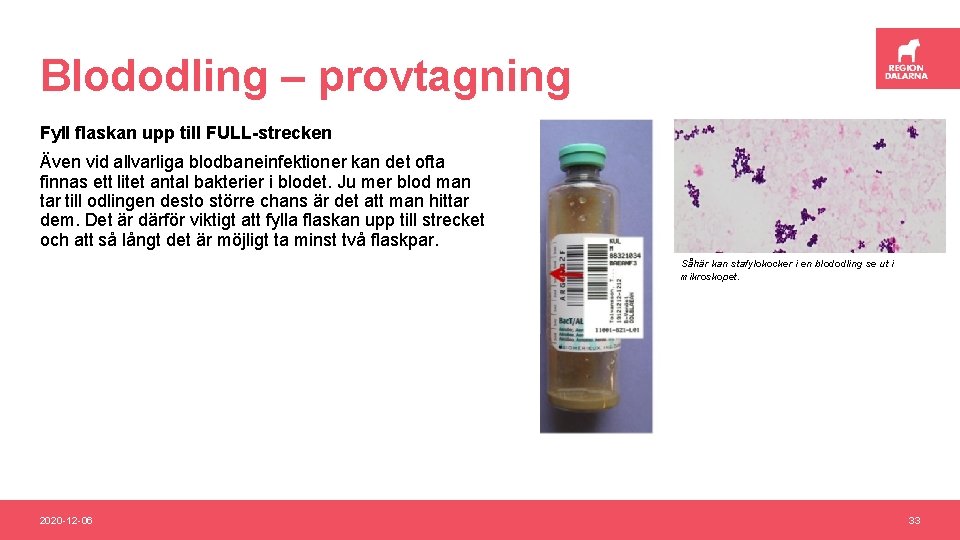 Blododling – provtagning Fyll flaskan upp till FULL-strecken Även vid allvarliga blodbaneinfektioner kan det