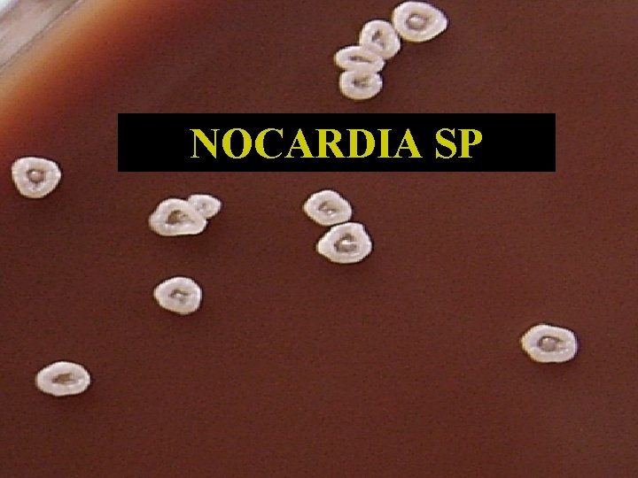 NOCARDIA SP 