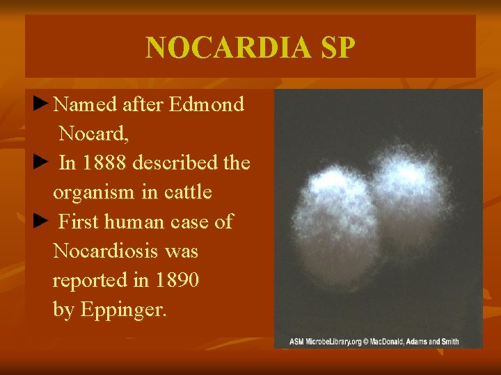 NOCARDIA SP ►Named after Edmond Nocard, ► In 1888 described the organism in cattle