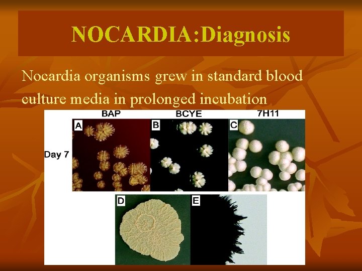 NOCARDIA: Diagnosis Nocardia organisms grew in standard blood culture media in prolonged incubation 