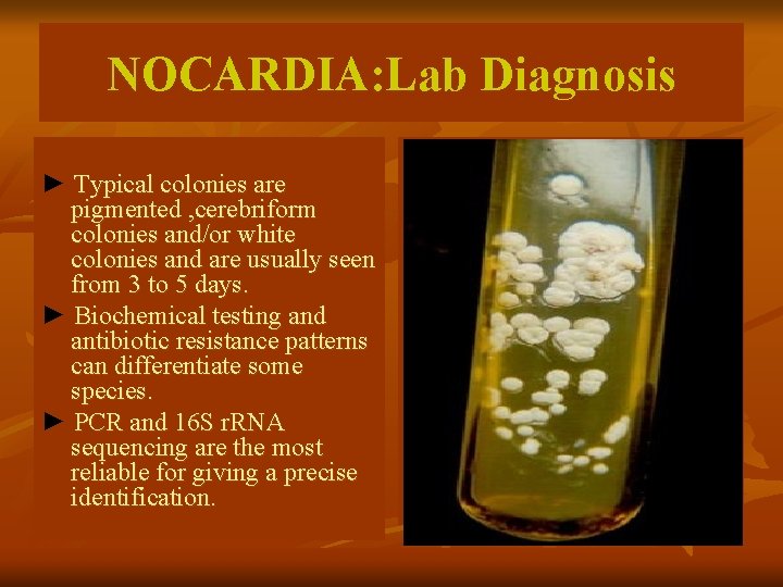 NOCARDIA: Lab Diagnosis ► Typical colonies are pigmented , cerebriform colonies and/or white colonies