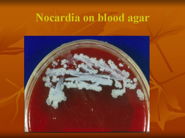 Nocardia on blood agar 