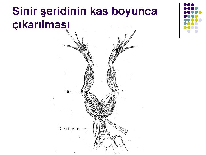 Sinir şeridinin kas boyunca çıkarılması 