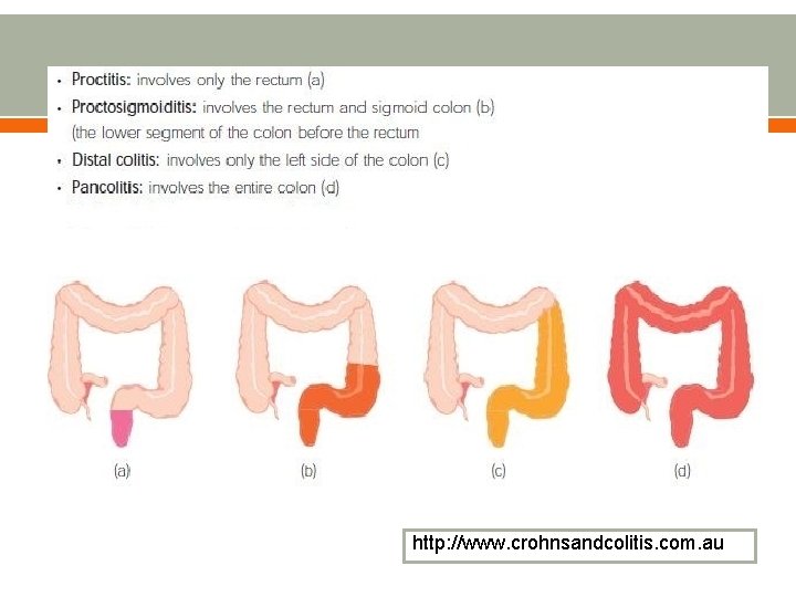 http: //www. crohnsandcolitis. com. au 