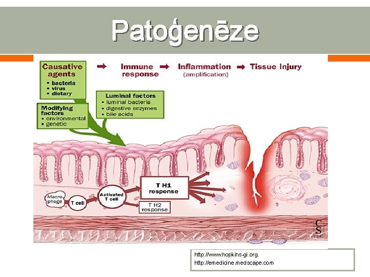 Patoģenēze http: //www. hopkins-gi. org. http: //emedicine. medscape. com 