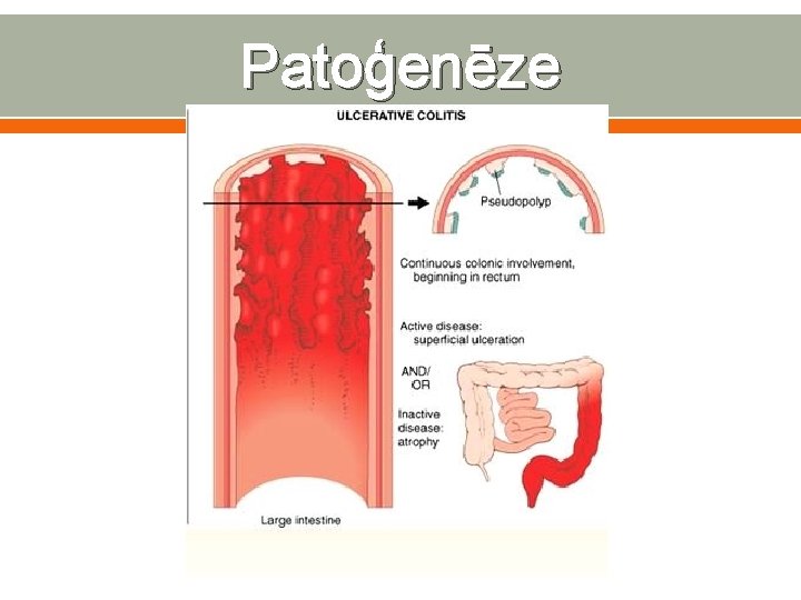 Patoģenēze 