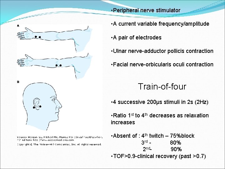  • Peripheral nerve stimulator • A current variable frequency/amplitude • A pair of