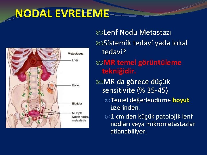 NODAL EVRELEME Lenf Nodu Metastazı Sistemik tedavi yada lokal tedavi? MR temel görüntüleme tekniğidir.