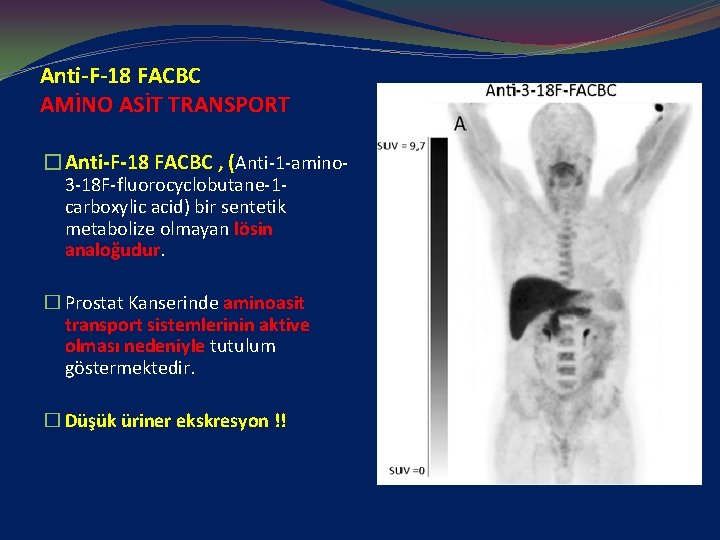 Anti-F-18 FACBC AMİNO ASİT TRANSPORT �Anti-F-18 FACBC , (Anti-1 -amino 3 -18 F-fluorocyclobutane-1 carboxylic