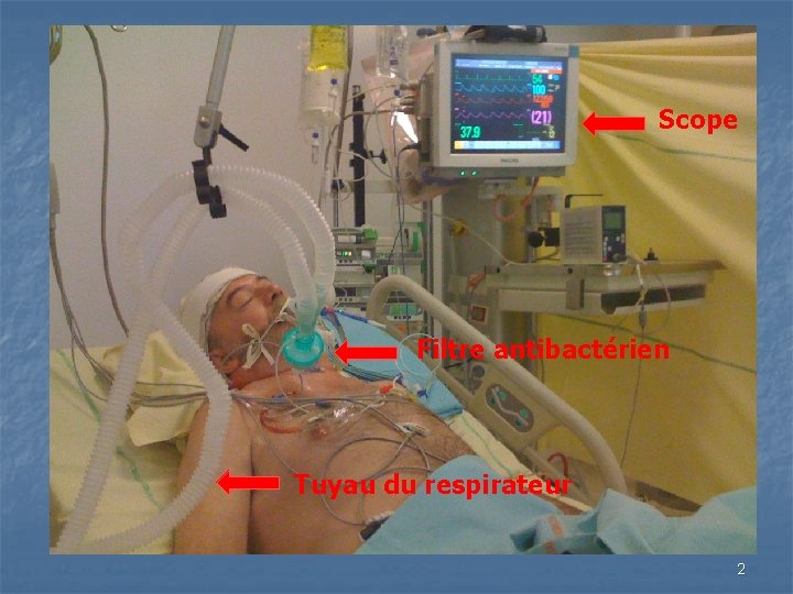 Scope Filtre antibactérien Tuyau du respirateur 2 