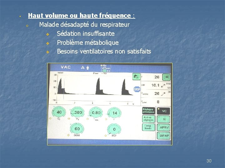  • Haut volume ou haute fréquence : o Malade désadapté du respirateur v