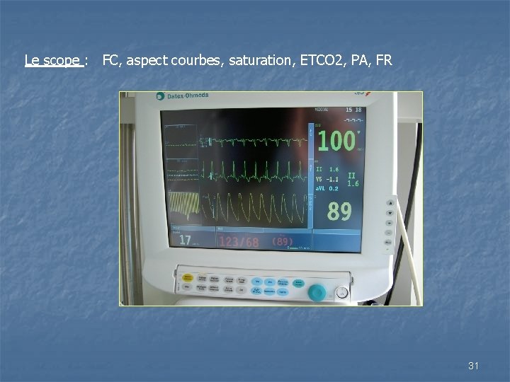 Le scope : FC, aspect courbes, saturation, ETCO 2, PA, FR 31 