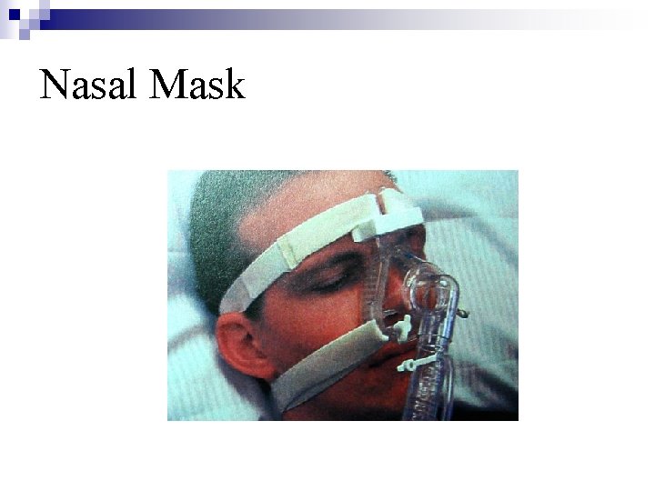 Nasal Mask 