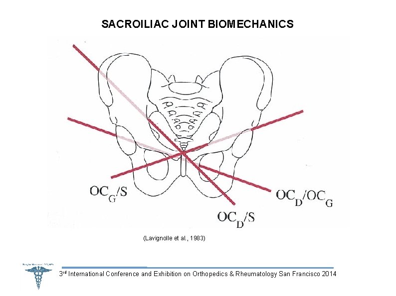 SACROILIAC JOINT BIOMECHANICS (Lavignolle et al. , 1983) 3 rd International Conference and Exhibition