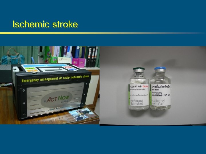 Ischemic stroke 