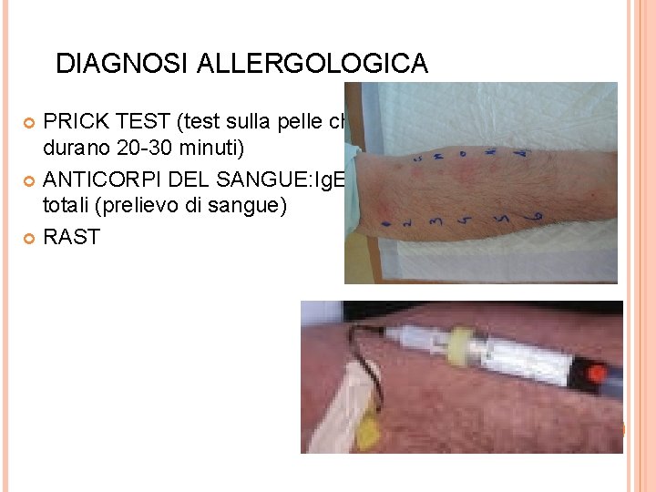 DIAGNOSI ALLERGOLOGICA PRICK TEST (test sulla pelle che durano 20 -30 minuti) ANTICORPI DEL