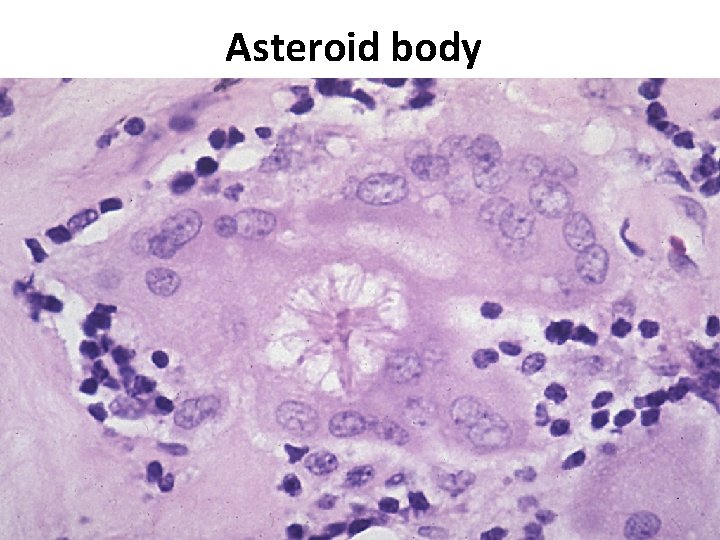 Asteroid body 