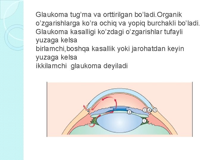 Glaukoma tug’ma va orttirilgan bo’ladi. Organik o’zgarishlarga ko’ra ochiq va yopiq burchakli bo’ladi. Glaukoma