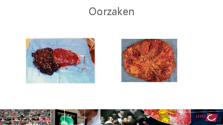 Oorzaken 