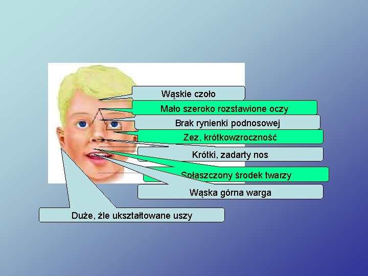 Wąskie czoło Mało szeroko rozstawione oczy Brak rynienki podnosowej Zez, krótkowzroczność Krótki, zadarty nos