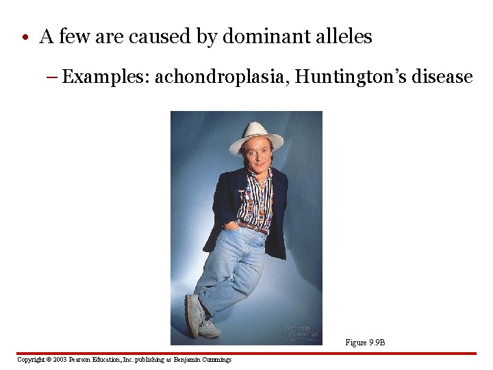  • A few are caused by dominant alleles – Examples: achondroplasia, Huntington’s disease