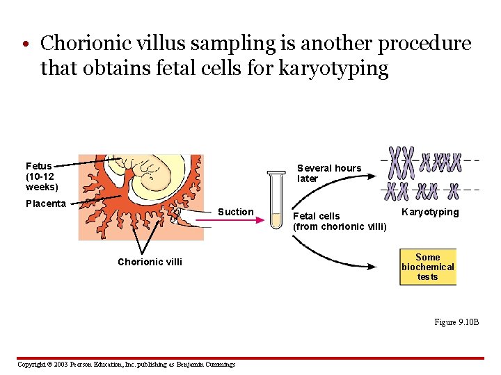  • Chorionic villus sampling is another procedure that obtains fetal cells for karyotyping