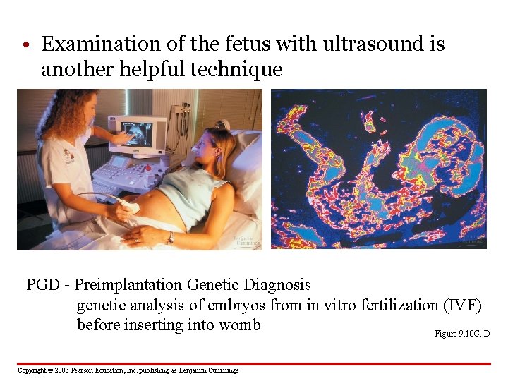  • Examination of the fetus with ultrasound is another helpful technique PGD -