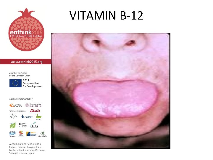 VITAMIN B-12 