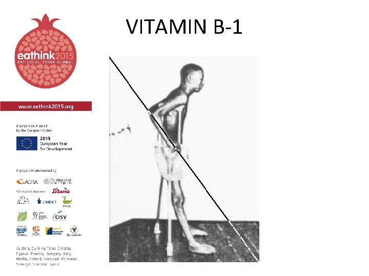 VITAMIN B-1 