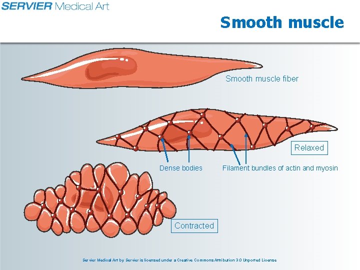 Smooth muscle fiber Relaxed Dense bodies Filament bundles of actin and myosin Contracted Servier
