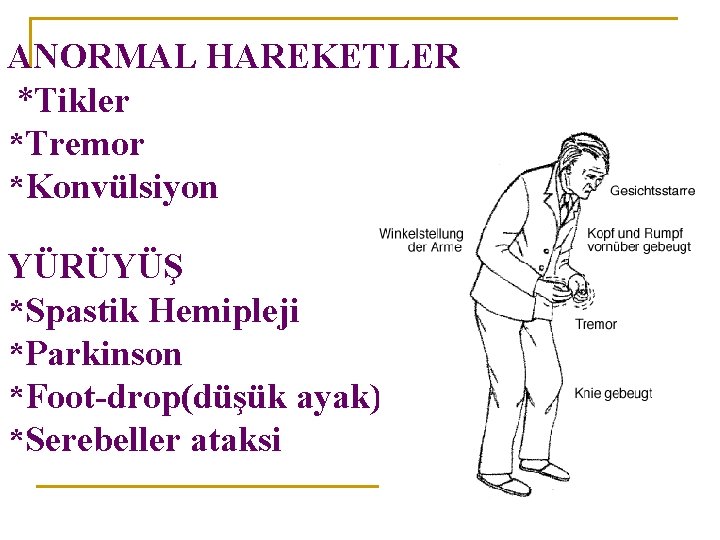 ANORMAL HAREKETLER *Tikler *Tremor *Konvülsiyon YÜRÜYÜŞ *Spastik Hemipleji *Parkinson *Foot-drop(düşük ayak) *Serebeller ataksi 