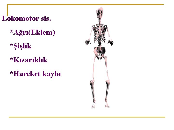 Lokomotor sis. *Ağrı(Eklem) *Şişlik *Kızarıklık *Hareket kaybı 