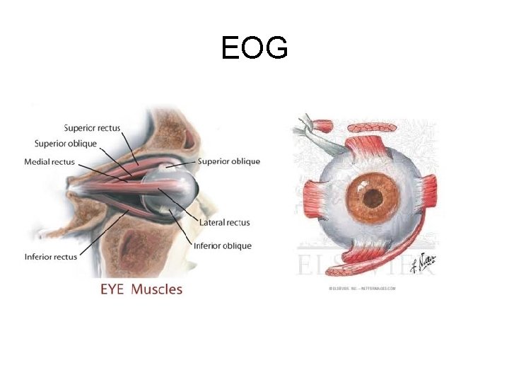 EOG 