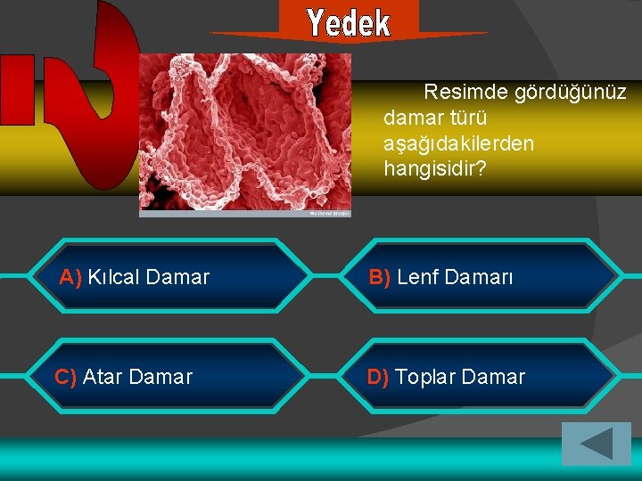 Resimde gördüğünüz damar türü aşağıdakilerden hangisidir? A) Kılcal Damar B) Lenf Damarı C) Atar