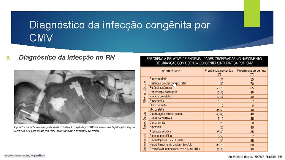 Diagnóstico da infecção congênita por CMV 3. Diagnóstico da infecção no RN 