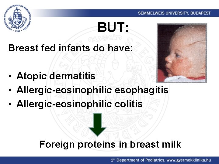 BUT: Breast fed infants do have: • Atopic dermatitis • Allergic-eosinophilic esophagitis • Allergic-eosinophilic