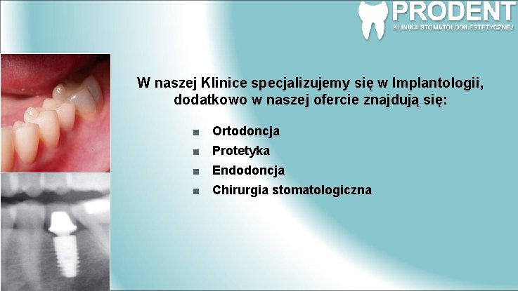 W naszej Klinice specjalizujemy się w Implantologii, dodatkowo w naszej ofercie znajdują się: Ortodoncja