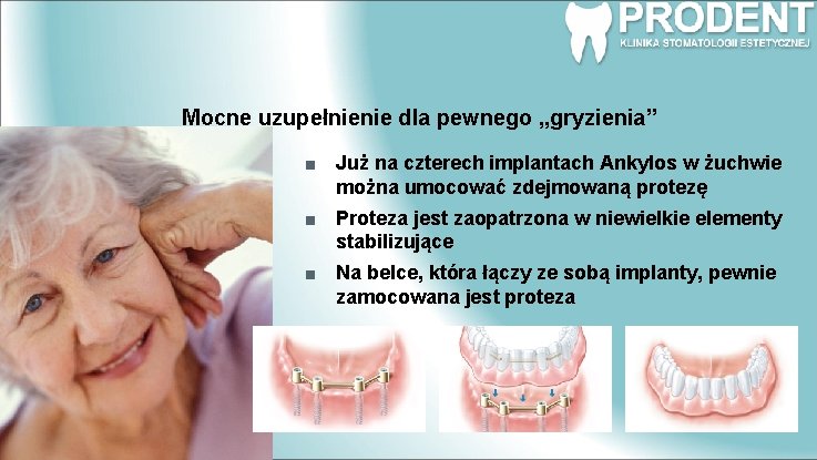 Mocne uzupełnienie dla pewnego „gryzienia” Już na czterech implantach Ankylos w żuchwie można umocować