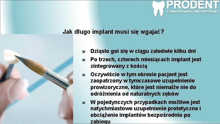 Jak długo implant musi się wgajać? Dziąsło goi się w ciągu zaledwie kilku dni