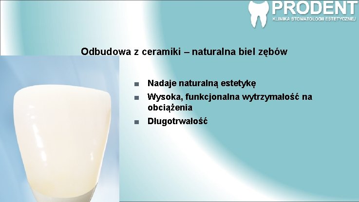 Odbudowa z ceramiki – naturalna biel zębów Nadaje naturalną estetykę Wysoka, funkcjonalna wytrzymałość na