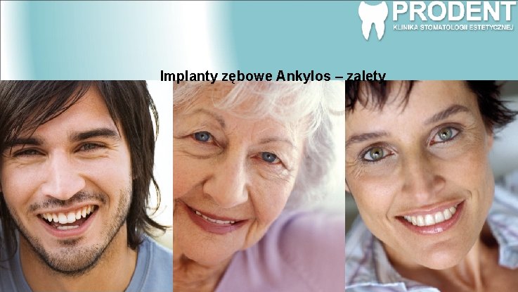 Implanty zębowe Ankylos – zalety 