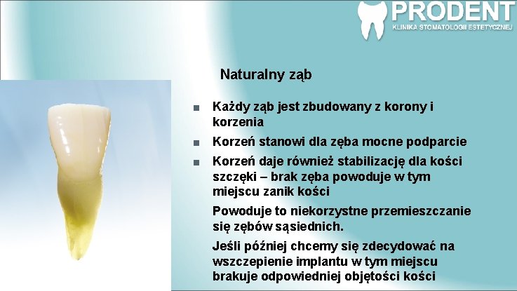 Naturalny ząb Każdy ząb jest zbudowany z korony i korzenia Korzeń stanowi dla zęba