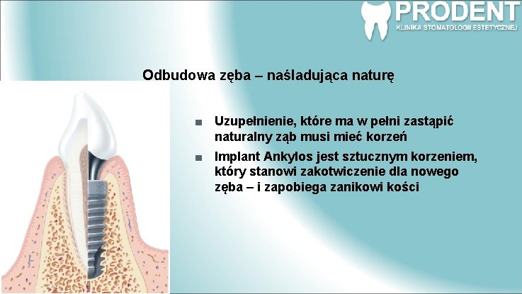 Odbudowa zęba – naśladująca naturę Uzupełnienie, które ma w pełni zastąpić naturalny ząb musi