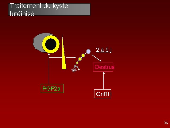 Traitement du kyste lutéinisé 2 à 5 j Oestrus PGF 2 a Gn. RH