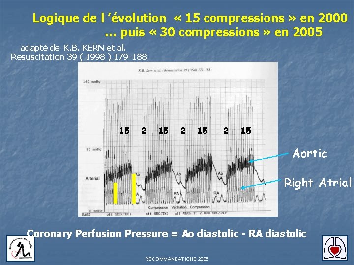 Logique de l ’évolution « 15 compressions » en 2000 … puis « 30