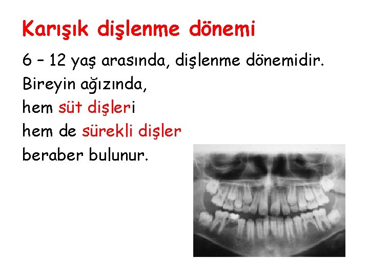 Karışık dişlenme dönemi 6 – 12 yaş arasında, dişlenme dönemidir. Bireyin ağızında, hem süt Karışık dişlenme dönemi 6 – 12 yaş arasında, dişlenme dönemidir. Bireyin ağızında, hem süt