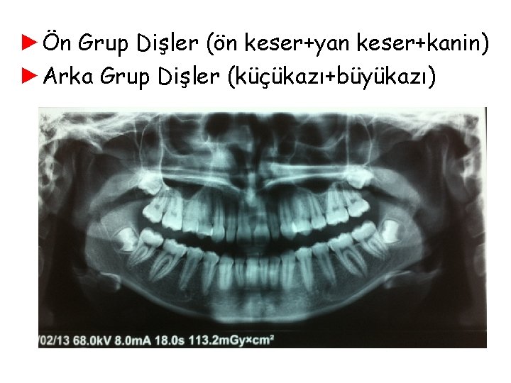 ►Ön Grup Dişler (ön keser+yan keser+kanin) ►Arka Grup Dişler (küçükazı+büyükazı) ►Ön Grup Dişler (ön keser+yan keser+kanin) ►Arka Grup Dişler (küçükazı+büyükazı)