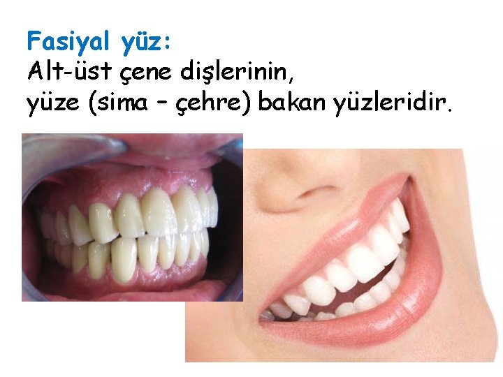 Fasiyal yüz: Alt-üst çene dişlerinin, yüze (sima – çehre) bakan yüzleridir. Fasiyal yüz: Alt-üst çene dişlerinin, yüze (sima – çehre) bakan yüzleridir.