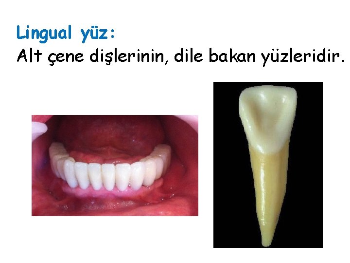 Lingual yüz: Alt çene dişlerinin, dile bakan yüzleridir. Lingual yüz: Alt çene dişlerinin, dile bakan yüzleridir.